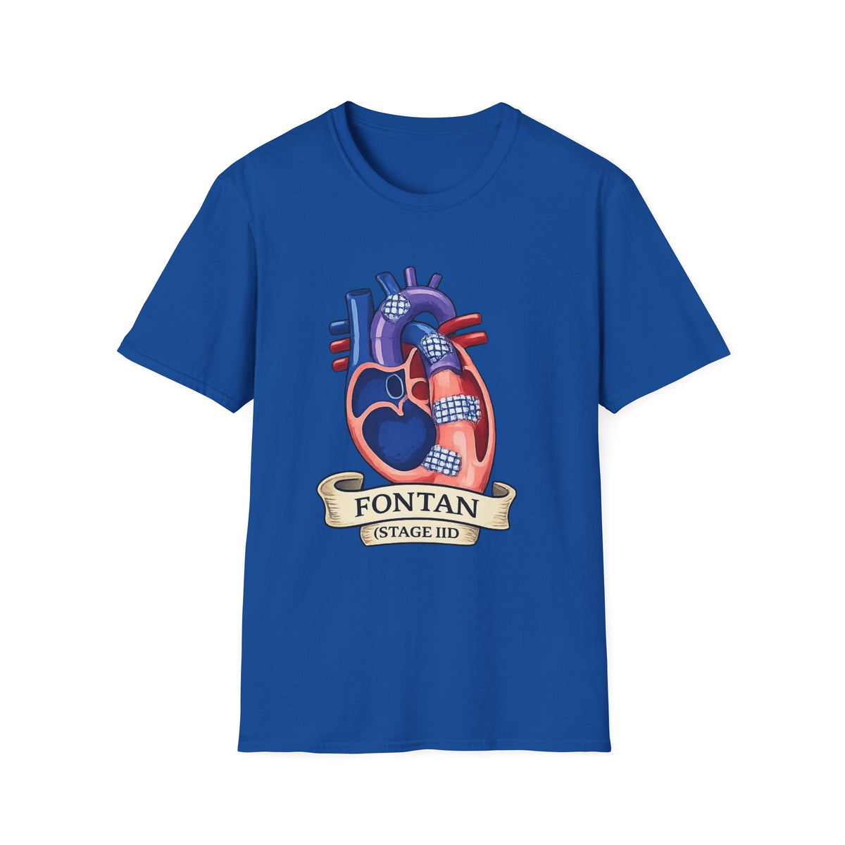Anatomical Heart T-Shirt — 'FONTAN (Stage I/II)' Medical Illustration Tee
